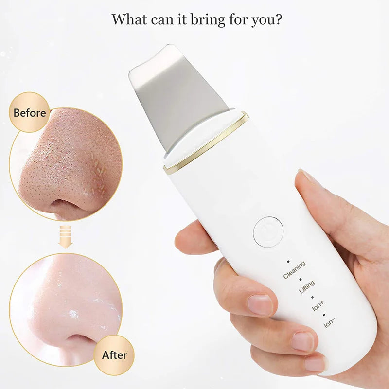 Ultrasonic Skin Scrubber Cosmetic Instrument Deep Cleansing Ultrasonic Cleansing Cavitation Peeling Shovel Rechargeable